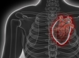 cardiac catheterization techniques