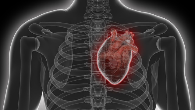 cardiac catheterization techniques